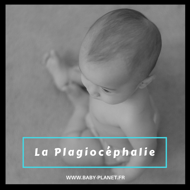 La plagiocéphalie, syndrome de la tête plate