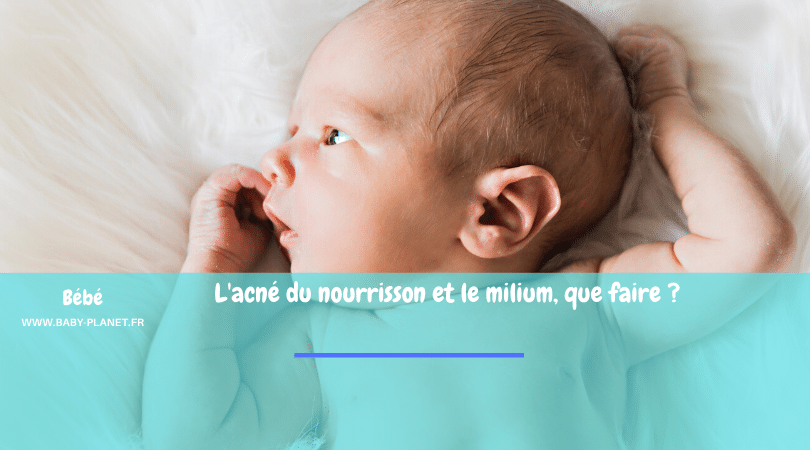 Acne Du Nourrisson Et Milium Que Faire Baby Planet